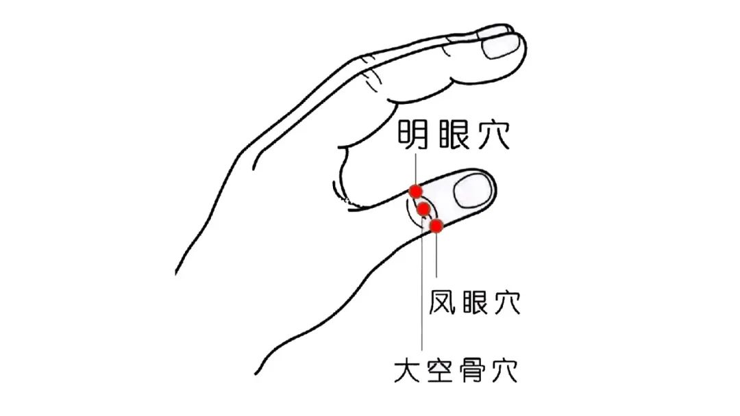 手上竟有恢复视力、通便的奇穴！适合所有人