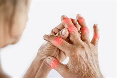 类风湿被称为“不死癌症”！中医三种办法，帮助缓解！
