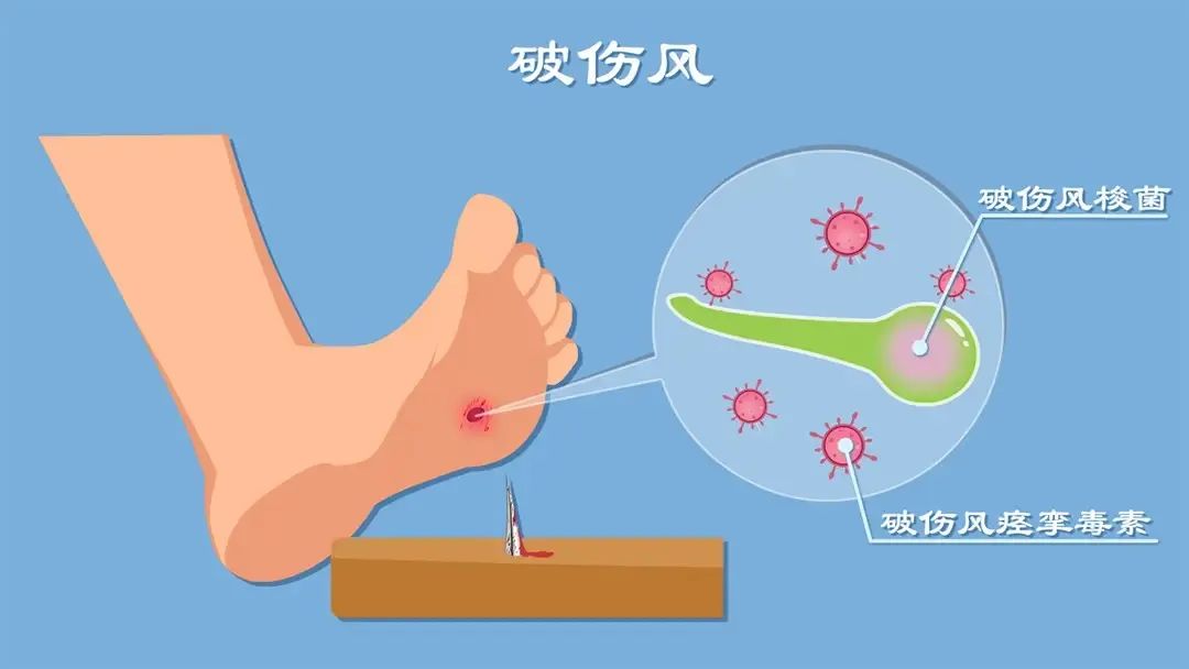 华佗治破伤风秘方