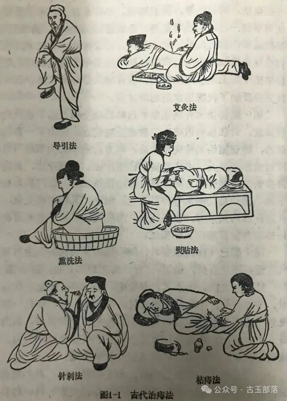 古人治痔疮的方法有多野