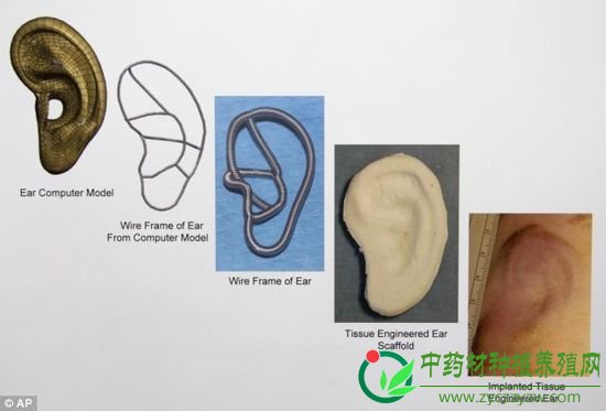 这组图片展示了从电脑建模到最终移植的人造耳培育全过程。