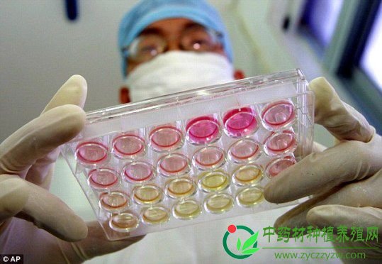 科学家解开艾滋病患者“自然痊愈”之谜（图）